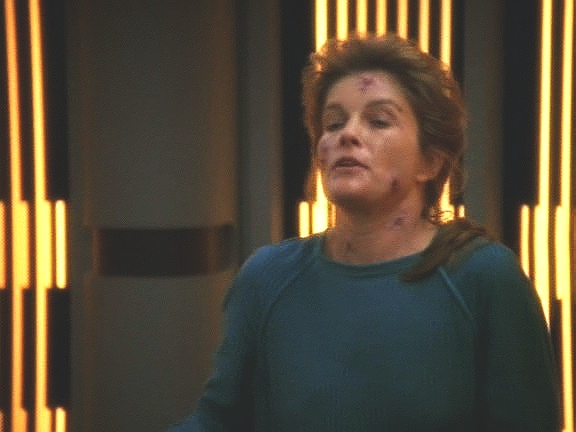 Čas ale vždy resetuje a jim se podaří vrátit se na Voyager. Kapitán je však nakažena virem phage a Doktor jí poskytne euthanasii nervovým toxinem.