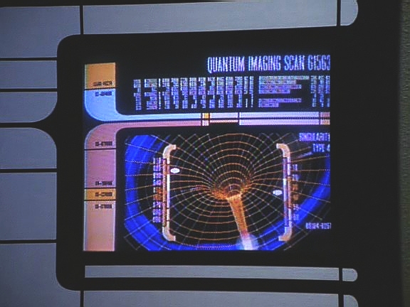 Zprvu to vypadá, že na Voyageru ústí červí díra, ale B'Elanna brzy zjistí, že to není pravda. Pak mizí také.