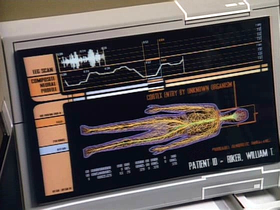 Infekce napadla Rikerův nervový systém a mimořádně rychle se šíří. Nezbývá moc času, než paralyzuje komandérův mozek a ten zemře.