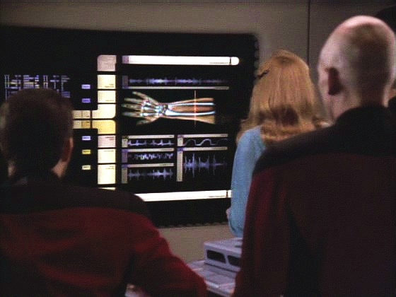 Beverly zjišťuje, že Rikerovi byla oddělena a zase připevněna paže v předloktí. Někdo záhadným způsobeme bere z lodi členy posádky a provádí na nich experimenty.