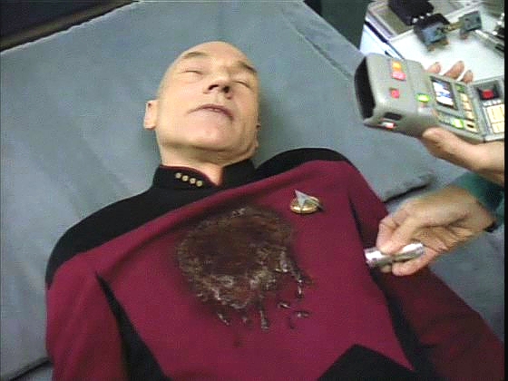 Zraněného kapitána Picarda přinesli na ošetřovnu a doktorka má plné ruce práce, když se snaží mu zachránit život. A vypadá to špatně...