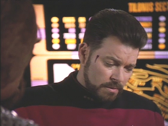 Riker má jít sám v přestrojení na Tilonus IV zmítaný politickými nepokoji, kde má najít několik pohřešovaných důstojníků Flotily. Při přípravě ho Worf nožem škrábne na spánku.